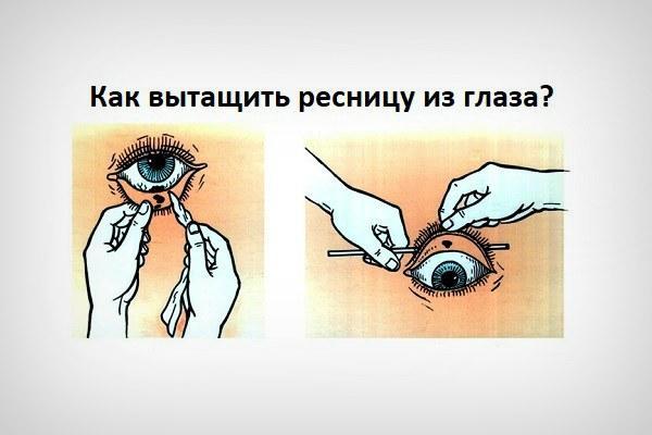 Способ вытащить ресницу или соринку из глаза
