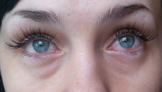 Опухшие глаза после наращивания ресниц