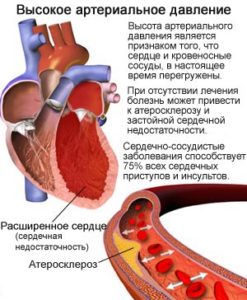 Нормальное ли артериальное давление 130 на 90 и нужно ли что-то делать?