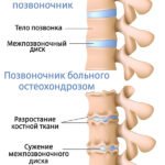 Болят глаза как будто давят и болит голова причины и что делать?