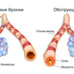 Болят глаза как будто давят и болит голова причины и что делать?