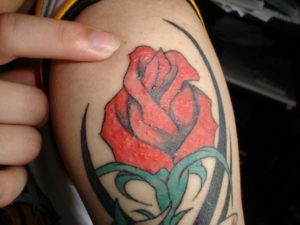 Аллергия на татуировку