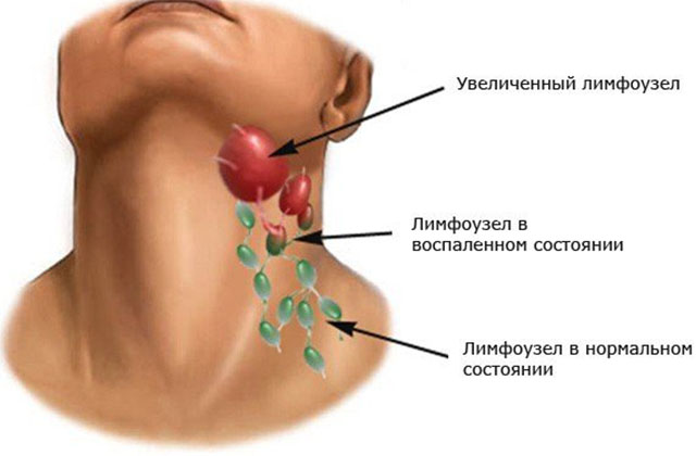 Анатомия слухового аппарата