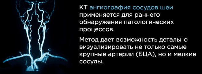 КТ ангиография сосудов шеи