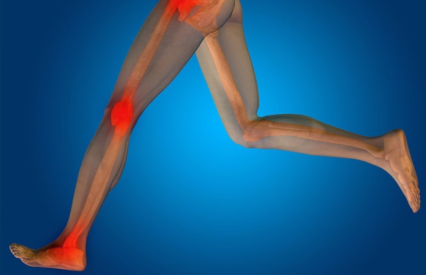 Щелчки в тазобедренном суставе: причина возникновения и особенности лечения