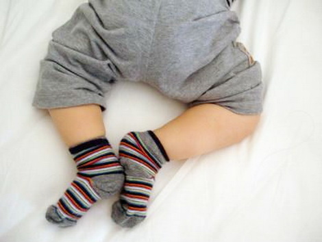 Дисплазия тазобедренных суставов у ребенка: симптомы, причины и терапия