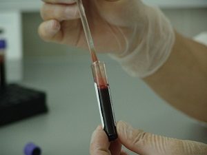 Анализ крови на ВПЧ