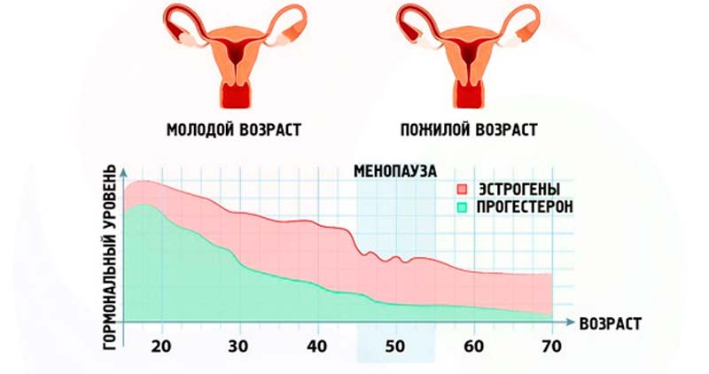гормоны при менопаузе