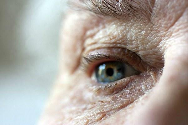 Вторичная глаукома у пожилого человека