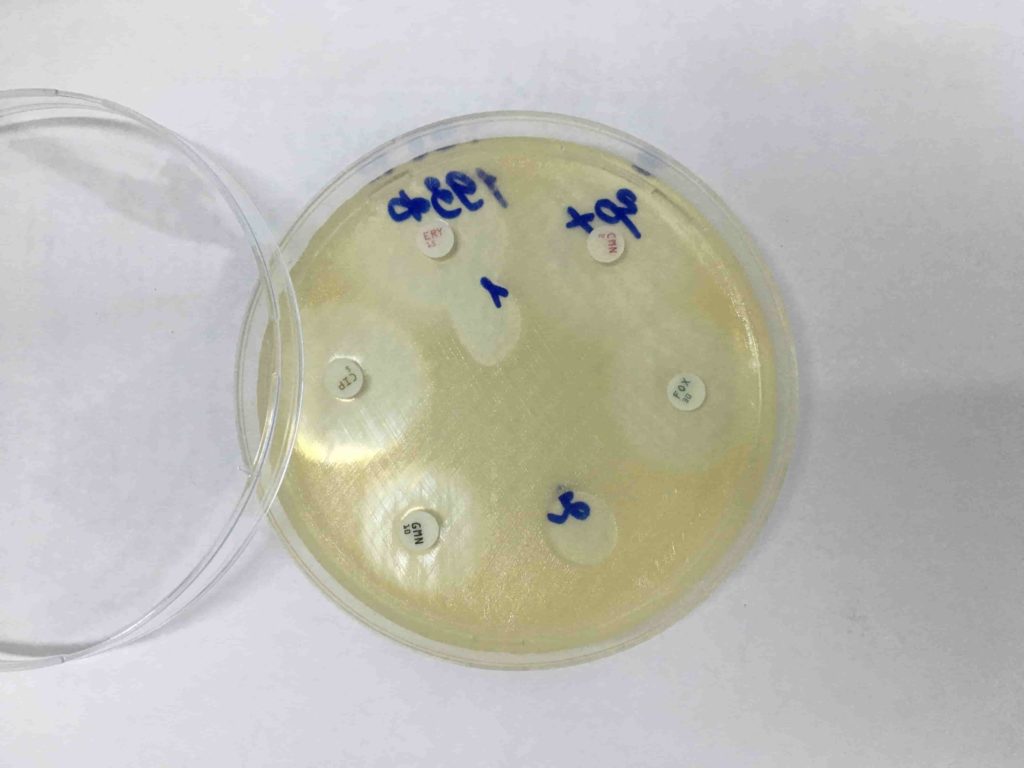 Может ли Staphylococcus aureus (золотистый стафилококк) стать причиной аллергии?