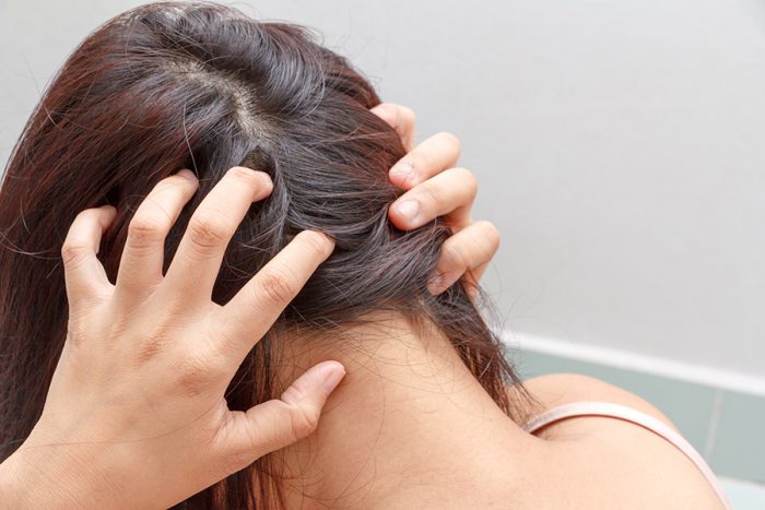 Аллергия на шампунь: какое средство по уходу за волосами выбрать, чтобы не заработать заболевание?