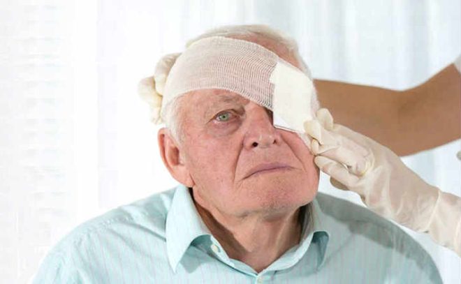 Защитная повязка на глаз после операции