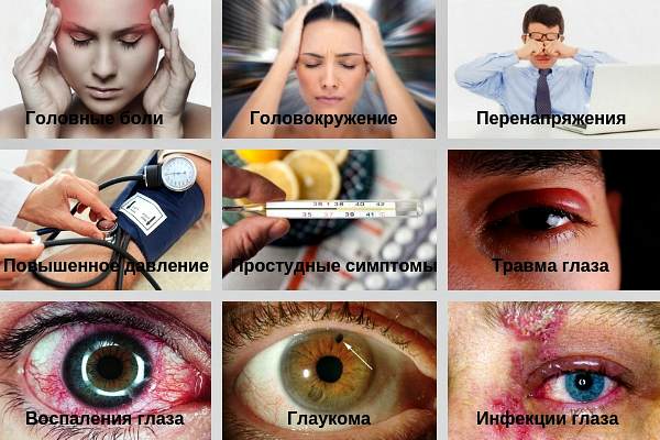 Сопутствующие симптомы боли глазного яблока