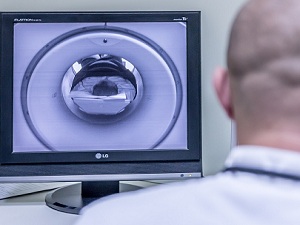 МРТ при диагностике жировика за ушной раковиной