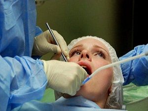 Возможные осложнения после операции по удалению полипов во рту