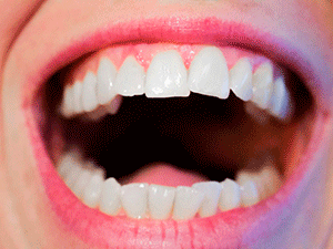 Что такое остеома челюсти