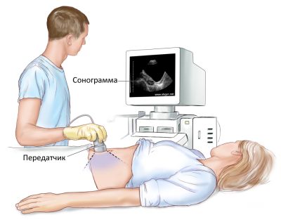 Как нужно подготовиться к проведению УЗИ почек?