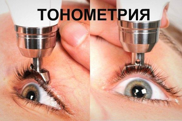 Тонометрия глаза