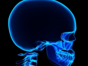 Остеома на голове: причины возникновения и симптомы, диагностика и методы лечения, реабилитация после вмешательства