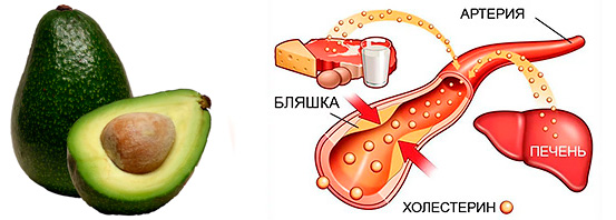 Влияние авокадо на холестерин