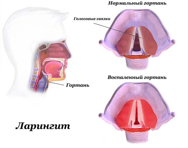 Гиперемия