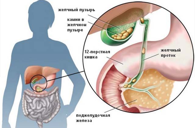 Заживление раны