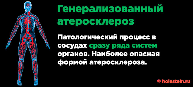 Код атеросклероза. Атеросклероз генерализованный 170.9. Генерализованный и неуточненный атеросклероз что это. Генерализованный атеросклероз диагноз. Генерализованный атеросклероз артерий нижних конечностей.