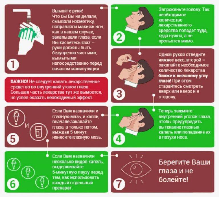 Что закапывать при конъюнктивите. Как правильно закапывать капли в глаза. Как правильно закапывать глазные капли в глаза. Как правильно закапывать глазные капли. КСК правильно закапывать капли виглаза.